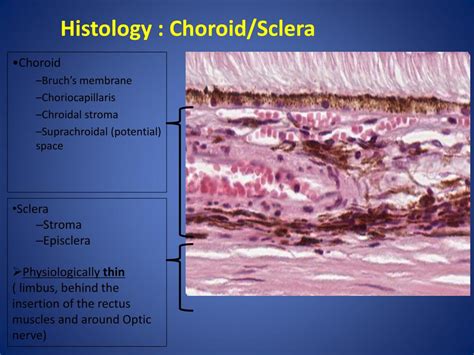 Ppt Ophthalmic Pathology Powerpoint Presentation Free Download Id