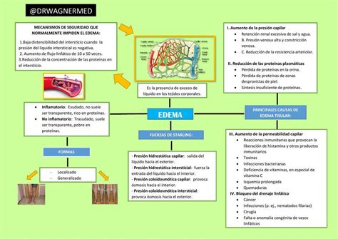 Mapa Conceptual Edema Renal Pulmonar Cardiaco Cerebral Medicina Porn