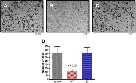 Elevated Expression Of Serine Protease Htra In Preeclampsia And Its