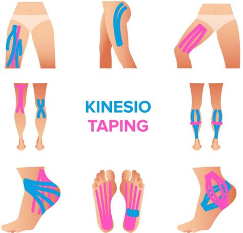 Kinesiology Tape - Dr Mathew Saturnino - Chiropractor in Vaughan