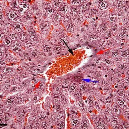 Pancreas In Group I Goldner Trichrome Stain Black Arrow Islet Of