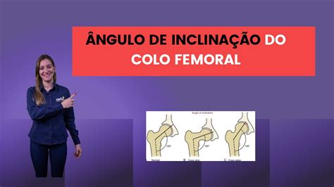 Ngulo De Inclina O Do Colo Femoral Youtube