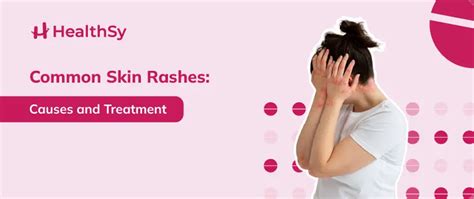 Common Skin Rashes: Causes and Treatment - HealthSy Article