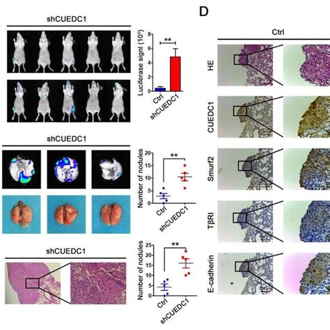 Cuedc1 Inhibited The Metastasis Of Nsclc In Vivo A A Total Of 1×10 6 Download Scientific