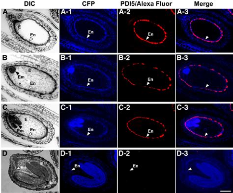 Fluorescent Micrographs Showing The Confinement Of Pdi Expression To