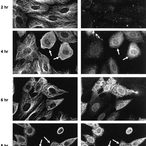 Vp Colocalizes With Mts In Hsv Infected Cells Vero Cells Were