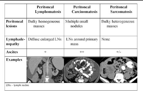 Figure From Peritoneal Lymphomatosis Ct And Pet Ct Findings And How