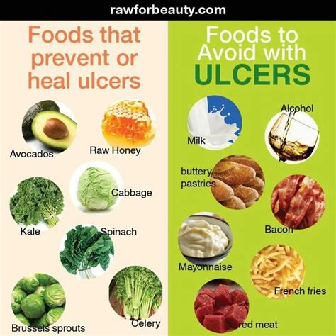 Helps ulcers | Sewing | Pinterest