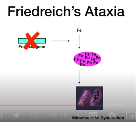 Uslme Step One Disease Cards Flashcards Quizlet