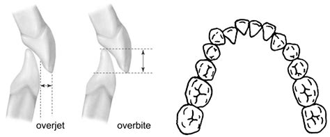 Ijerph Free Full Text Are The Reasons Why Patients Are Referred For An Orthodontic Visit