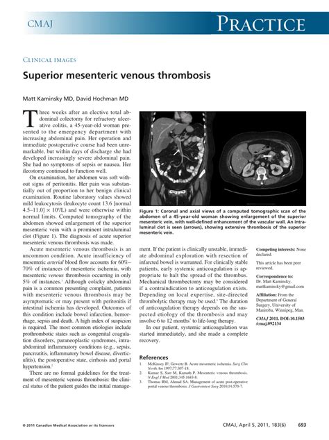 Pdf Superior Mesenteric Venous Thrombosis