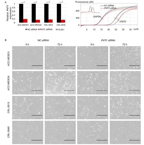 A Left Panel Knockdown Of Long Non Coding Rna Pvt1 Expression In