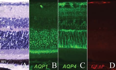 Expression Of Aquaporin 1 Aquaporin 4 And Glial Fibrillary Acidic