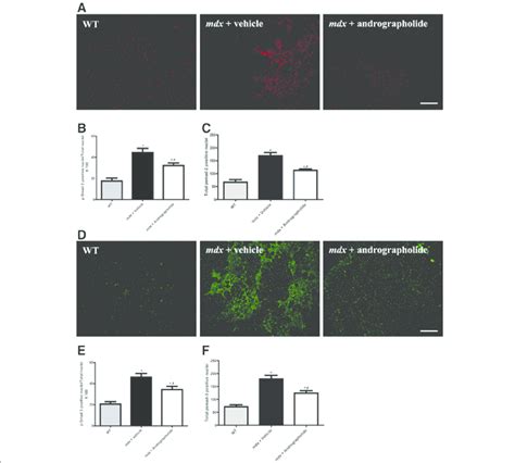 Andrographolide Reduces Transforming Growth Factor Type Beta Tgf β