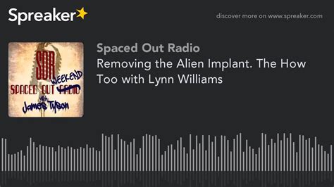 Removing The Alien Implant The How Too With Lynn Williams YouTube