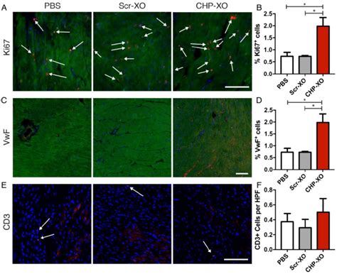 Myocardial Proliferation And Angiogenesis Cardiomyocyte Proliferation