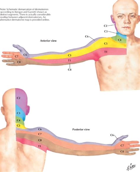 Dermatome Chart Neck - Dermatomes Chart and Map