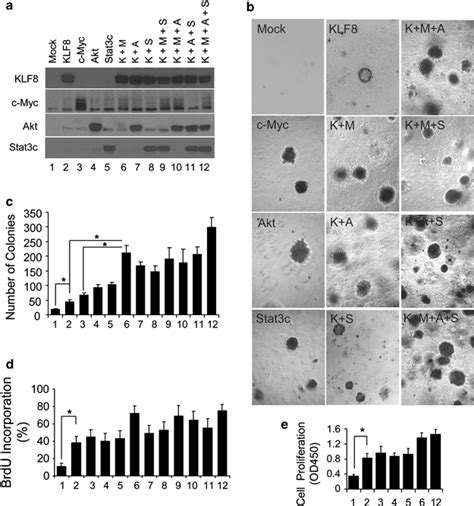 Overexpression Of Klf8 Transforms Human Ovarian Epithelial Cells A