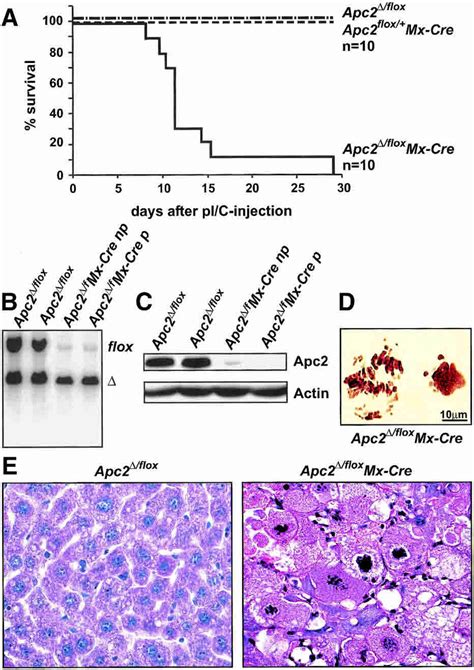 Liver Failure In Apc Flox Mx Cre Mice A Survival Curve Of Adult