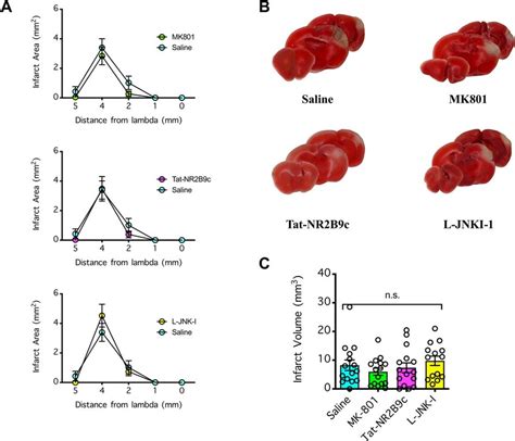 Effect Of Nmdar Antagonism On Brain Infarction Induced By Distal Middle