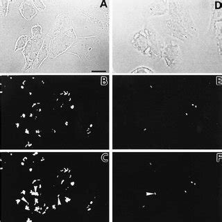 Schematic Representation Of The Fibronectin Binding Protein Sfbi The