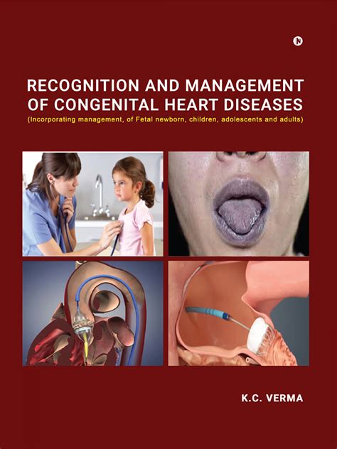 Recognition And Management Of Congenital Heart Diseases