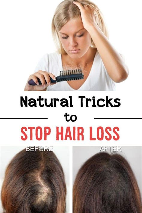 Natural Tricks To Stop Hair Loss Diva Secrets Natural Hair Loss Treatment Hair Loss