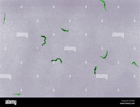 Treponema pallidum shown under dark field light microscopy Stock Photo ...