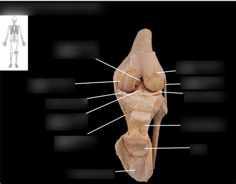 Knee Joint Anterior View Opened And Flexed Layer 3 Diagram Quizlet