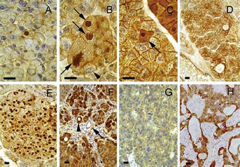 The Pattern Of Catenin Staining In The Pancreas Of Apcmin And Download Scientific Diagram