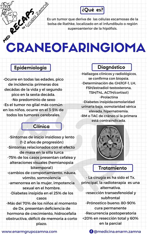 Craneofaringioma Pdf