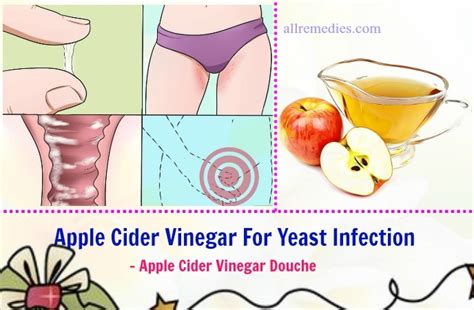 12 Tips Using Apple Cider Vinegar For Yeast Infection Treatment