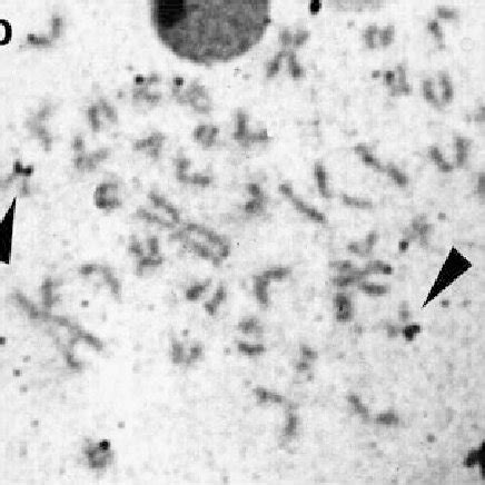 A Karyotype Of Porichthys Plectrodon Stained Conventionally With