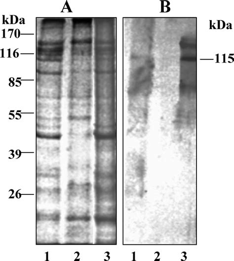 Recognition Of Entamoeba Histolytica Kda Surface Protein By Human