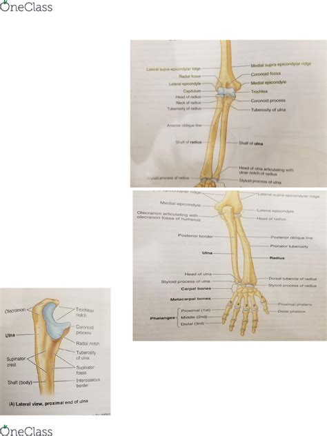 Ulnar Styloid Process Wikipedia, 59% OFF