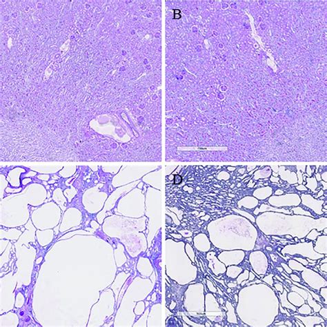 Representative Photomicrographs Of Sirius Red Stained Sections Of