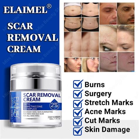 Scar Remover Peklat For Old And New Scar Scarminator Cream Strech Mark