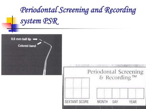 Ppt Pre Clinical Periodontics Powerpoint Presentation Id6147190