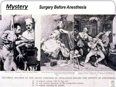 Past Present And Future Of Anesthesia Ppt Free Download