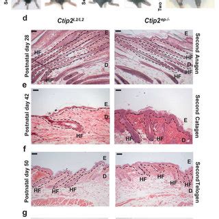 Conditional Ablation Of Ctip2 In Adult Epidermis Leads To Altered