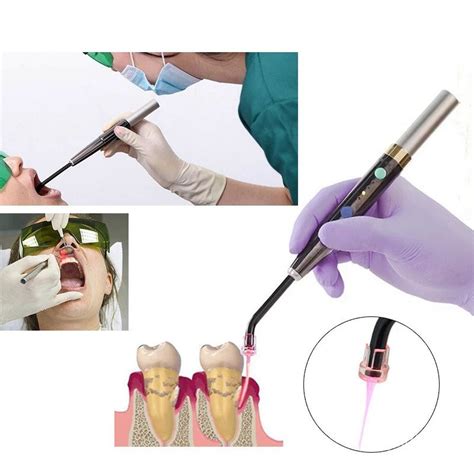 Dental Diode Low Level Laser Photo Activated Disinfection F3WW PAD