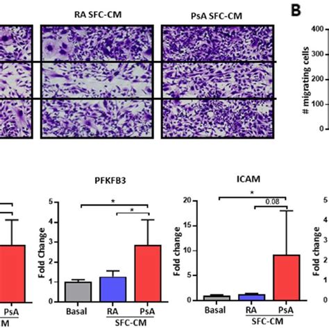 PsA SFC CM Induced HUVEC Migration A Representative Photomicrographs