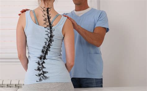 The Role Of Exercise In Kyphosis Correction Surgery Recovery ...