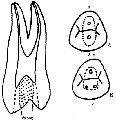 anatomy of premolar teeth