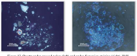 Figure 1 from Polarized light microscopy | Semantic Scholar