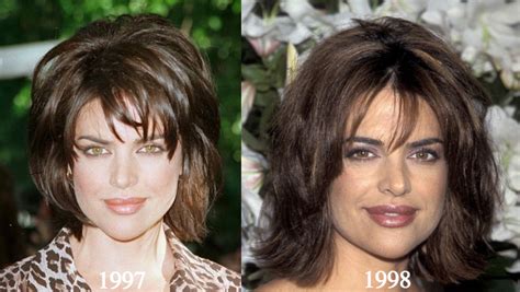 Lisa Rinna Plastic Surgery Before and After Photos - Latest Plastic Surgery Gossip And News ...