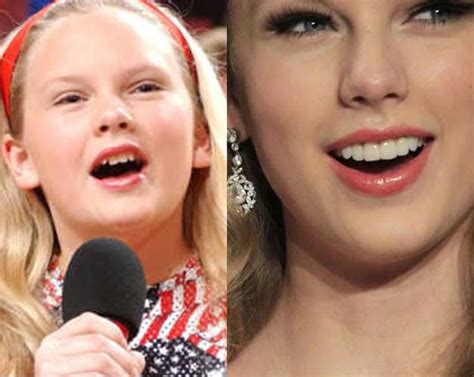 Taylor Swift Plastic Surgery: Nose job, Boob Job, Butt Implant