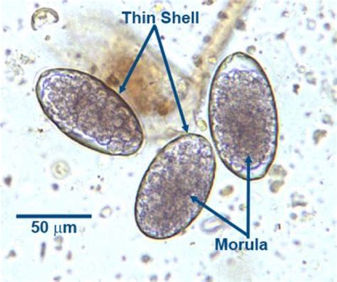 Parasitology Exam 2 Nematodes In Ruminants Cattle And Swine