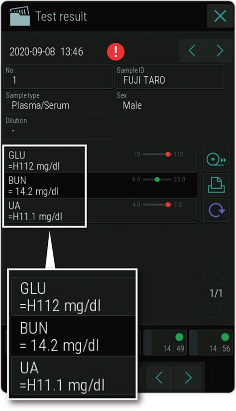 Dri Chem Nx Fujifilm Espa A