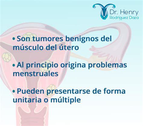 Qué es un Mioma Uterino Causas Síntomas Diagnóstico y Tratamiento